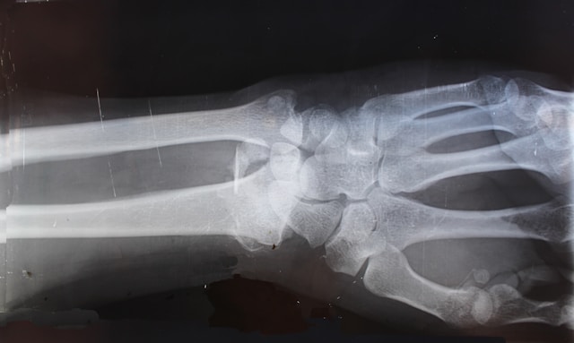 What to Do If Your Personal Injury Claim Is Denied